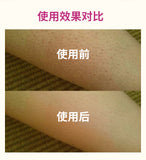 Kobayashi Pharmaceutical Leg Removes Chicken Skin Cutin And Softens Hair Follicle Ointment 20g去雞皮角質軟化毛囊藥膏